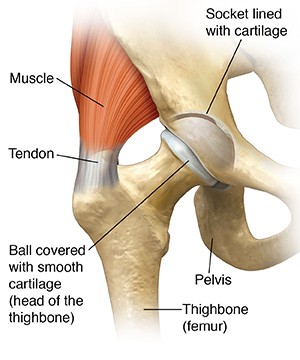 Hip joint, showing muscle, tendon, thighbone, and pelvis around it, and ball of thighbone and socket lined with cartilage.