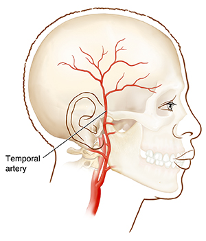 Side view of head showing the temporal artery.