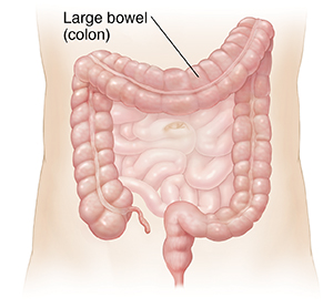 Outline of abdomen showing small intestine and large intestine (colon).colon.