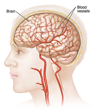 Side view of head, showing brain and blood vessels to the brain.