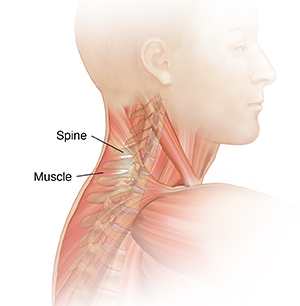 Side view of male head and neck showing spine and neck muscles.