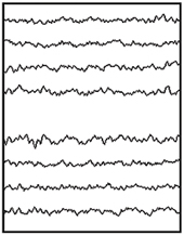 Registro de EEG normal.