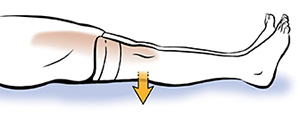 Leg from knee down showing quadriceps sets.