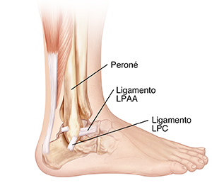 Vista lateral de los huesos de la parte inferior de la pierna y del pie donde se observan el ligamento talofibular posterior, el ligamento calcaneofibular y el ligamento talofibular anterior.
